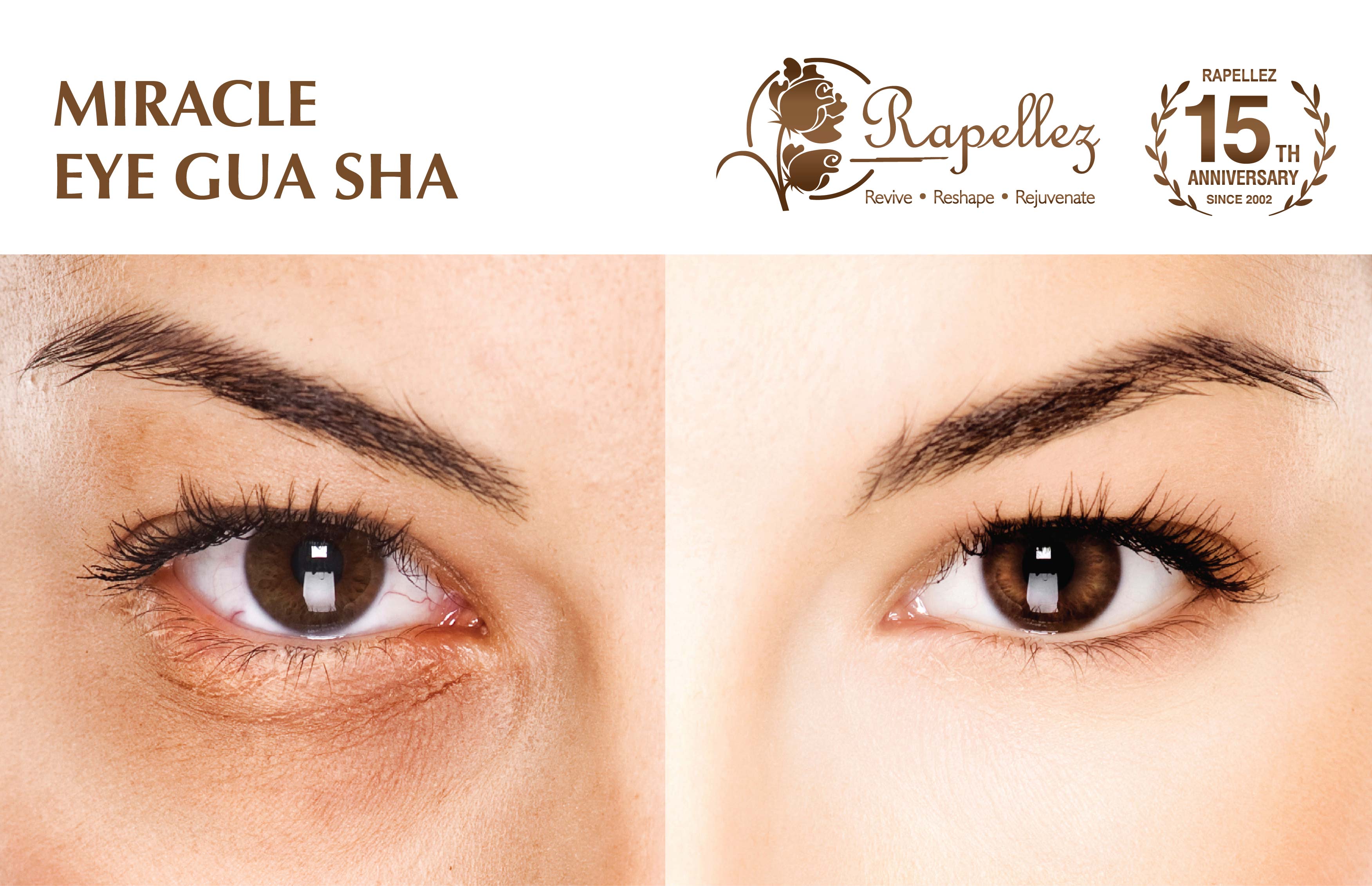 Miracle Eye Gua Sha – First Trial (u.p. S$180, 45min)