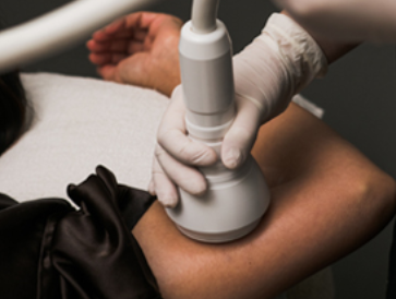 Cool Rf Treatment