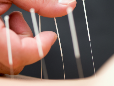 Metabolic Inducing Shi-Style Acupuncture